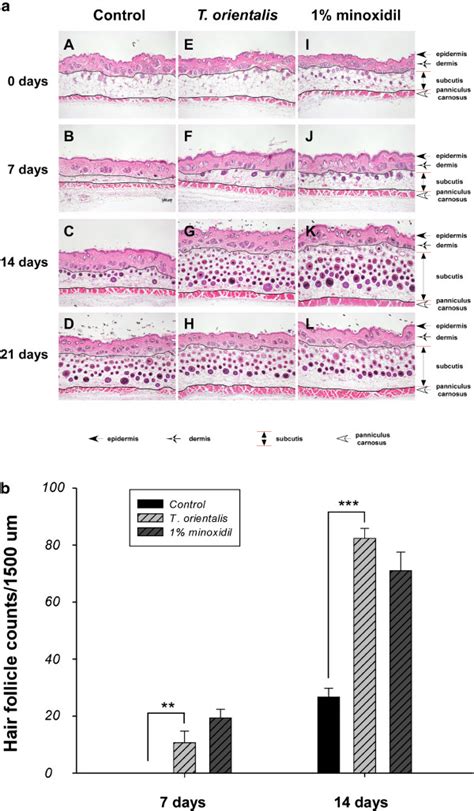 Hair Follicle Growth In Telogen Matched C Bl N Mice Treated With T