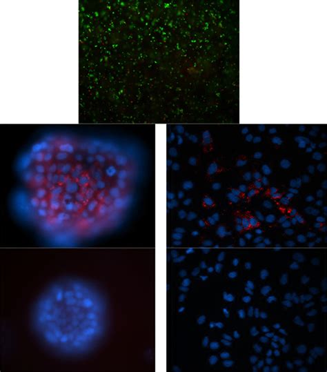 Hcv Infection Of Huh 75 Cells In Hydrogels A Viability Of