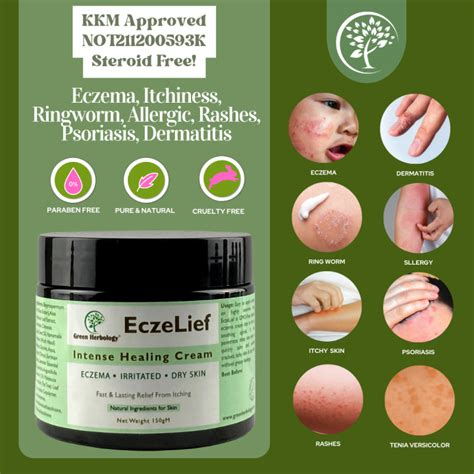 EczeLief Natural Eczema Cream Ekzema Psoriasis Itchy Skin KKM