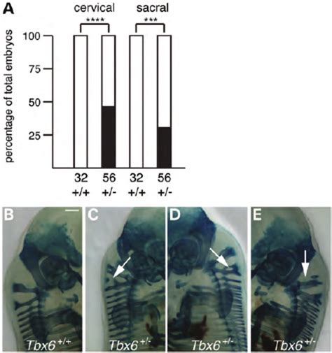 Heterozygous Null Tbx6 Mouse Embryos Have Mild Vertebral Defects With