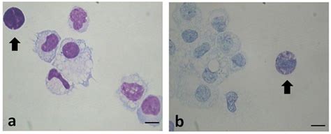 Frontiers Mast Cells In Peritoneal Fluid From Women With