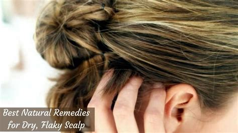 10 Best Natural Remedies For Dry Flaky Scalp