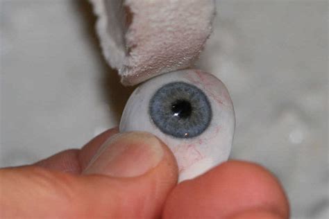 Prosthetic Eyes New Zealand Prosthetic Eye Service