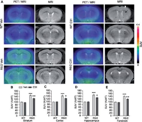 Figure From Tspopet Imaging Using F Pbr Is A Potential