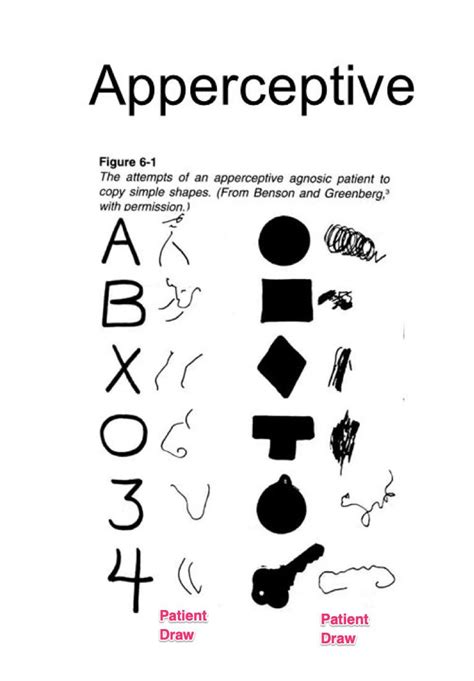 What Is Visual Agnosia Defintion Localization Types Neurostat