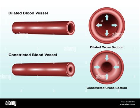 Blood Vessel Constriction Hi Res Stock Photography And Images Alamy