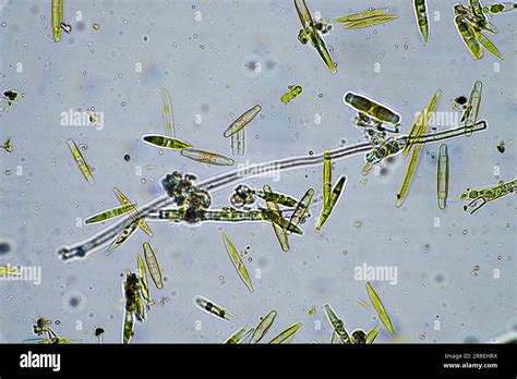 Microorganisms In Pond Water Under Microscope