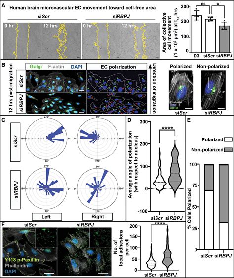 Rbpj Deficiency Disrupts Vascular Remodeling Via Abnormal Apelin And