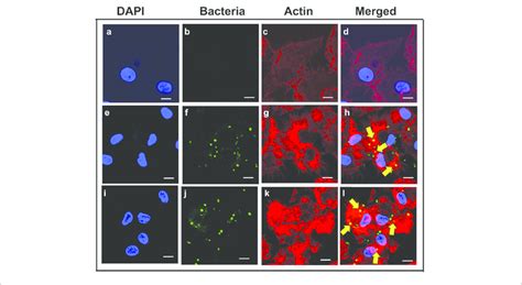 Pseudomonas Aeruginosa Induces Actin Cytoskeletal Rearrangements