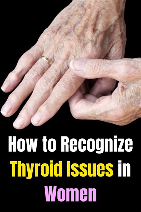 Signs Of Thyroid Artofit