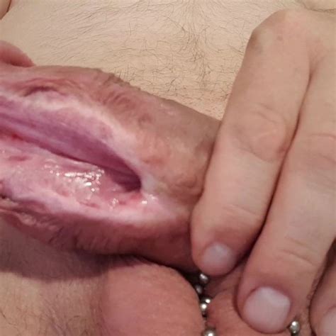 My Subincision Free HD Videos HD Porn Video F XHamster XHamster