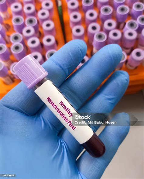 Blood Sample For Hereditary Hemochromatosis Panel Test A Disorder Of