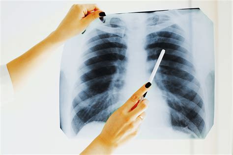 Reasons To Begin A Career In Radiology Harcourt Health