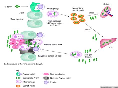 Typhoid Fever & Paratyphoid Fevers A, B, and