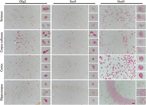 Frontiers Tau Isoform Driven Cbd Pathology Transmission In