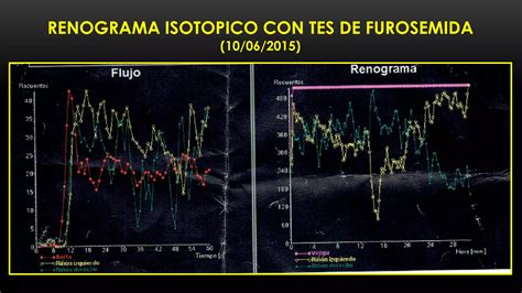 Caso Clinico Necrosis Tubular Aguda Ppt