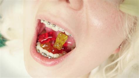 Asmr Mukbang In Braces Chewing And Swallowing Jelly Teddybears Giantess Vore Mouth Tour