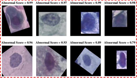 Examples Of Correctly Classified Abnormal Cervical Cells From Herlev