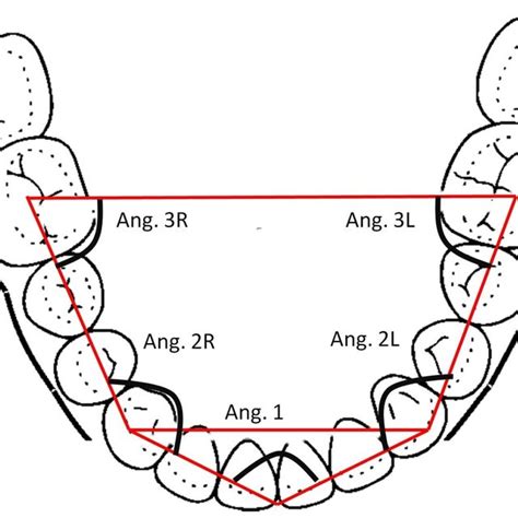 Pdf Relationship Between Vertical Facial Patterns And Dental Arch