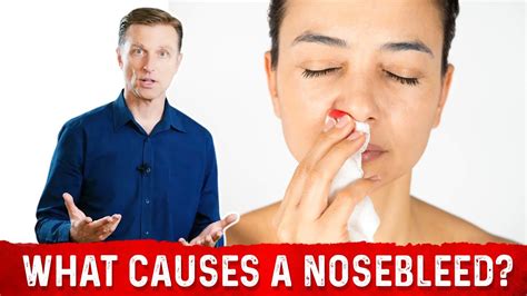 What Causes Nosebleeds Epistaxis 8 Common Causes Of Nose Bleeding