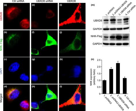 Pathogenic Mutation Of UBQLN2 Impairs Its Interaction With UBXD8 And