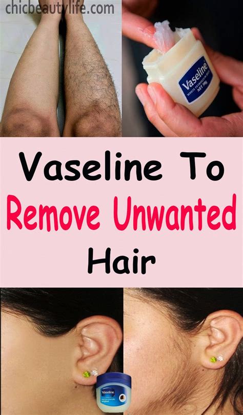 Pin On Remove Unwanted Hair