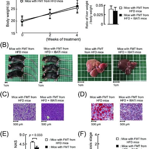 Influence Of Fecal Microbiota Transplantation FMT On Gut Microbiota