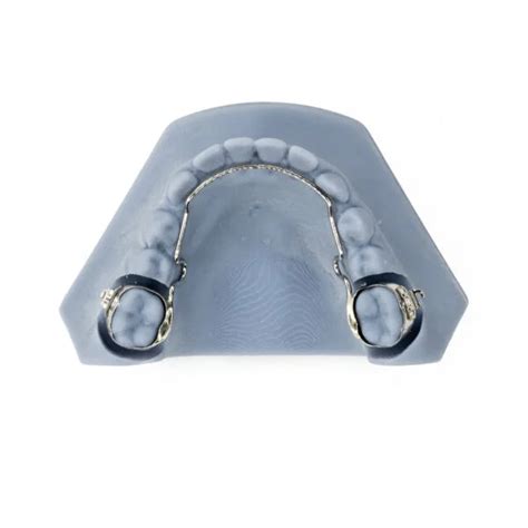 Llha Lower Lingual Holding Arch Motif Orthodontic Arts