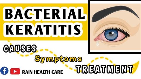 Bacterial Keratitis Bacterial Keratitis Keya He Sign Symptoms And Treatment Of Bacterial