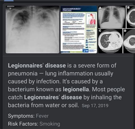 Spanish Flu, Legionaries Disease, & COVID19 – The New Political Campaign – EhMaritimeSecret