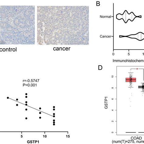 GSTP1 Is Upregulated In CRC Tissues And Negatively With MiR 506 3p A