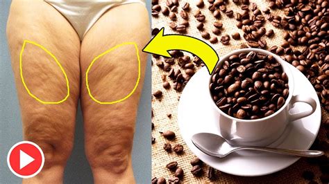 Do Coffee Scrubs Treat Cellulite Coffee Scrub For Cellulite And Stretch Marks Remedies One