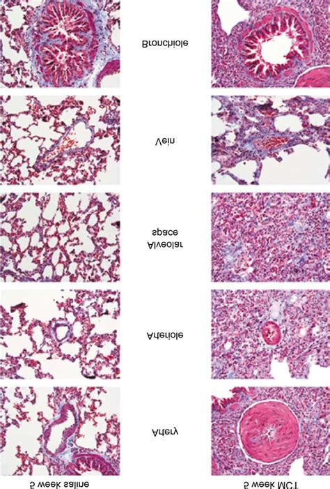 Photomicrograph Of The Lung Sections Stained With Masson S Trichrome