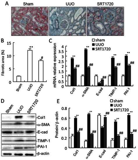 The Sirt Activator Srt Attenuates Renal Fibrosis By Inhibiting