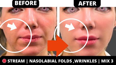 Face Lifting Exercises For Smile Lines Nasolabial Folds Jowls Saggy