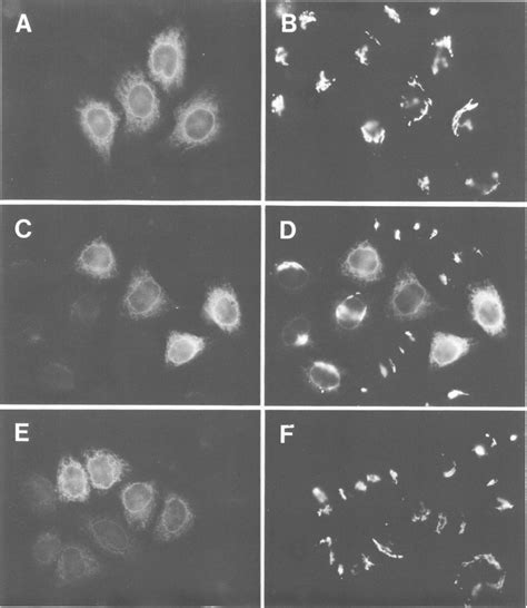 Immunofluorescence Microscopy Of Mann Ii Hela Cells Transfected With Download Scientific