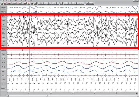 File:Sleep EEG Stage 4.jpg - Wikipedia