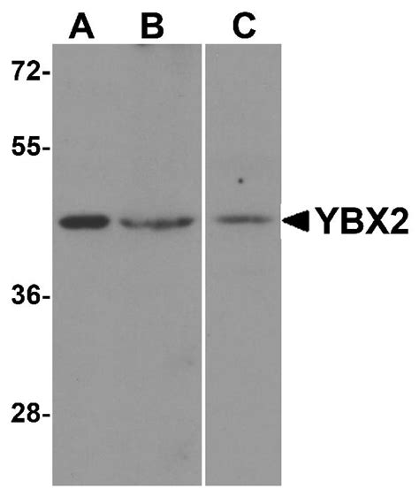 Y Box Binding Protein 2 YBX2 Antibody