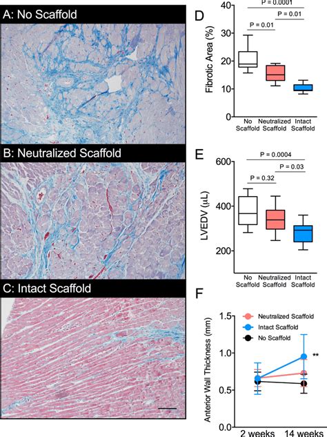 Intact Bioscaffolds Attenuate Post MI Structural Cardiac Remodeling