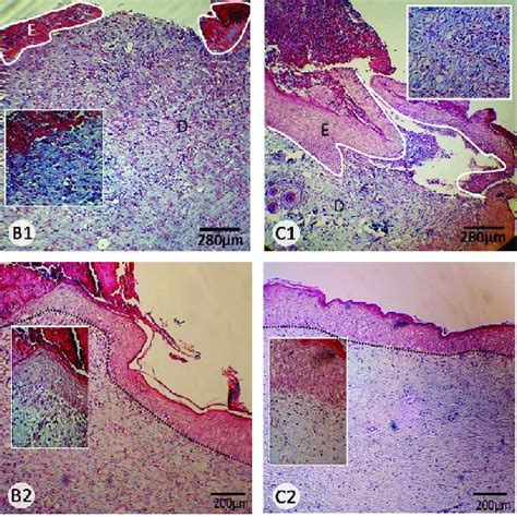 Histological Features Of Experimentally Induced Wounds 7 Days Following