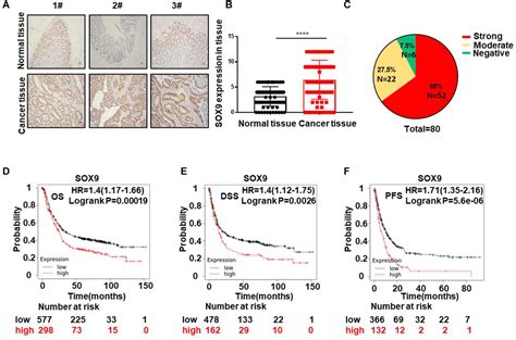 Frontiers The Sox Mms L Axis Promotes Oxaliplatin Resistance In