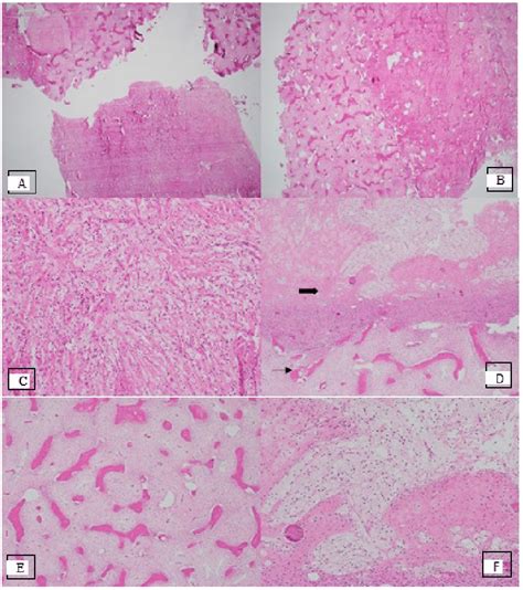 A Histological Section Of Lsmft Stained With Hematoxylin And Eosin