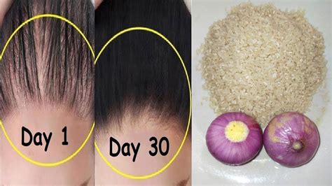 How To Long Stop Hair Fall With Onion Rice In Urdu Balon Ko Lamba