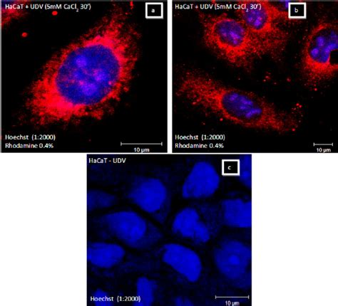 Confocal Microscopy Of Rhodamine Udv Uptake By Cells A And B And A