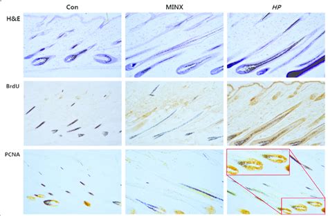 Microscopic Observation Of Hair Follicle In C Bl Mice Histologic