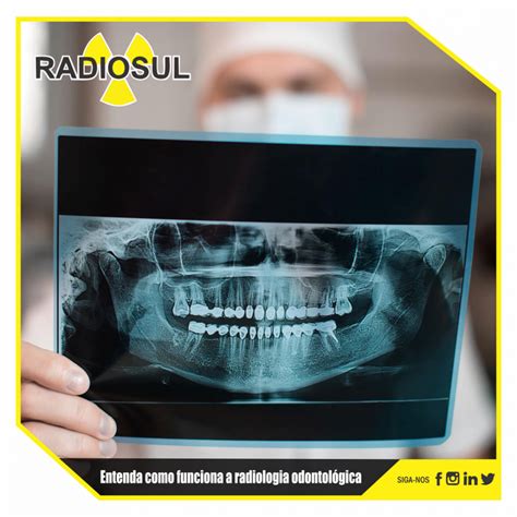 Radiosul Digital Entenda Como Funciona A Radiologia Odontol Gica