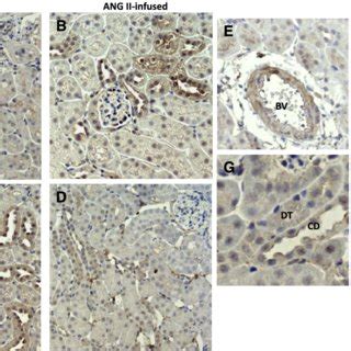 Immunohistochemistry Analysis Of The Effect Of Chronic ANG II Infusions