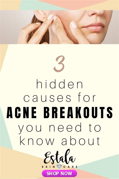 3 hidden causes for acne breakouts you need to know about! Is your acne ...