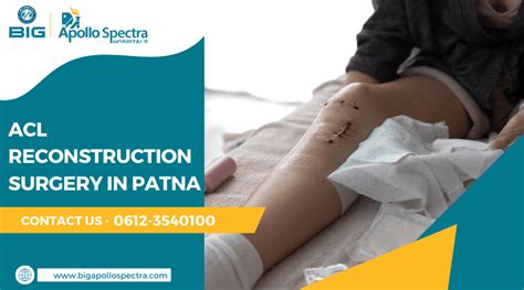 ACL Reconstruction Surgery in Patna – Cost & Patient Reviews