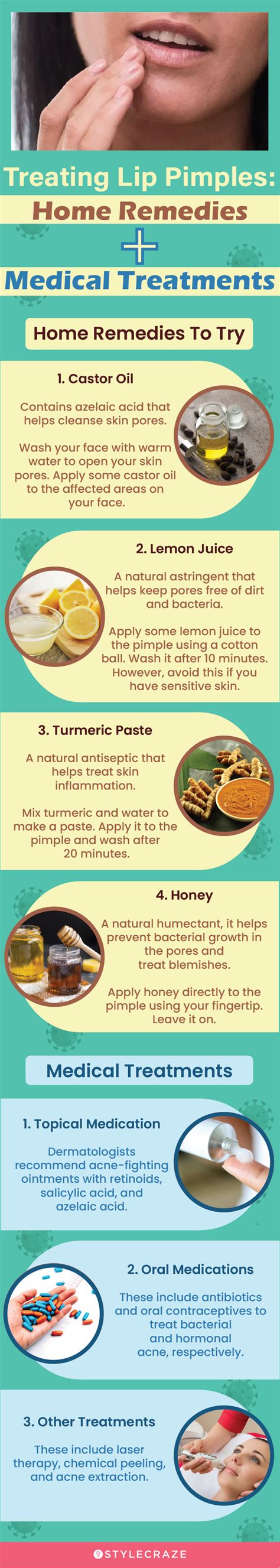 How To Get Rid Of Pimple On Lip: Remedies & Prevention